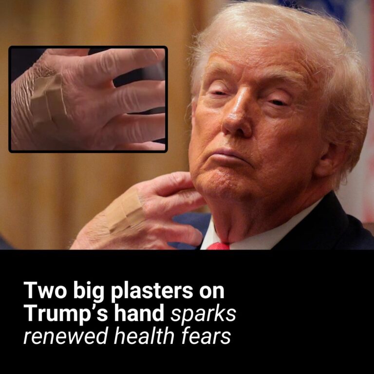 Trump brags about intelligence before dozing off in meeting and showing bandaged hand