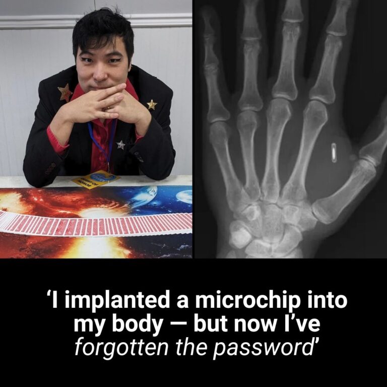 ‘I implanted a microchip into my body — but now I’ve forgotten the password’