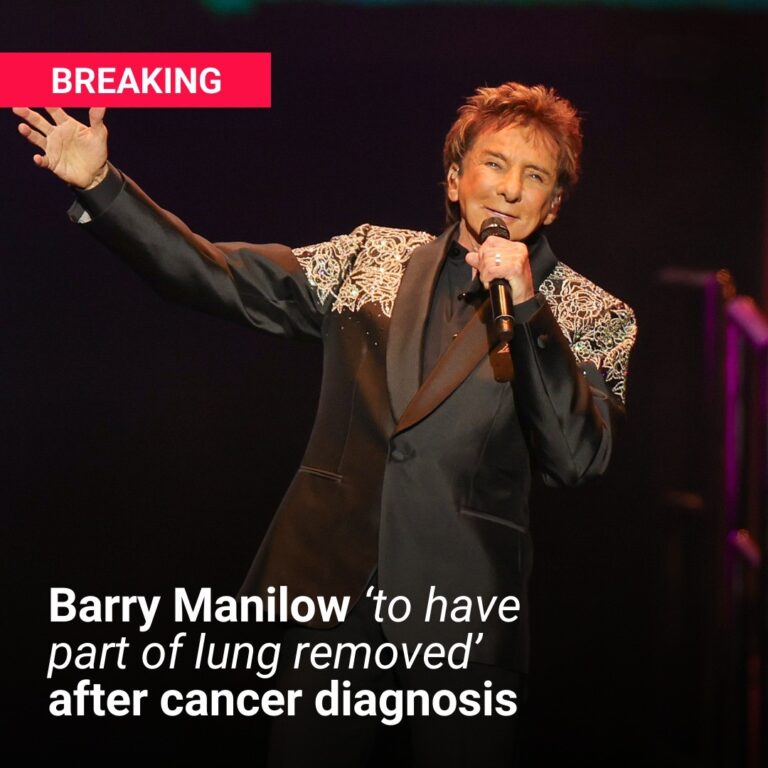 Barry Manilow, 82, ‘to have part of lung removed’ after cancer diagnosis