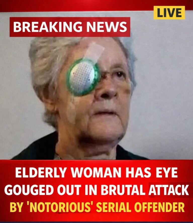Elderly woman has eye gouged out in brutal random attack by ‘notorious’ repeat offender