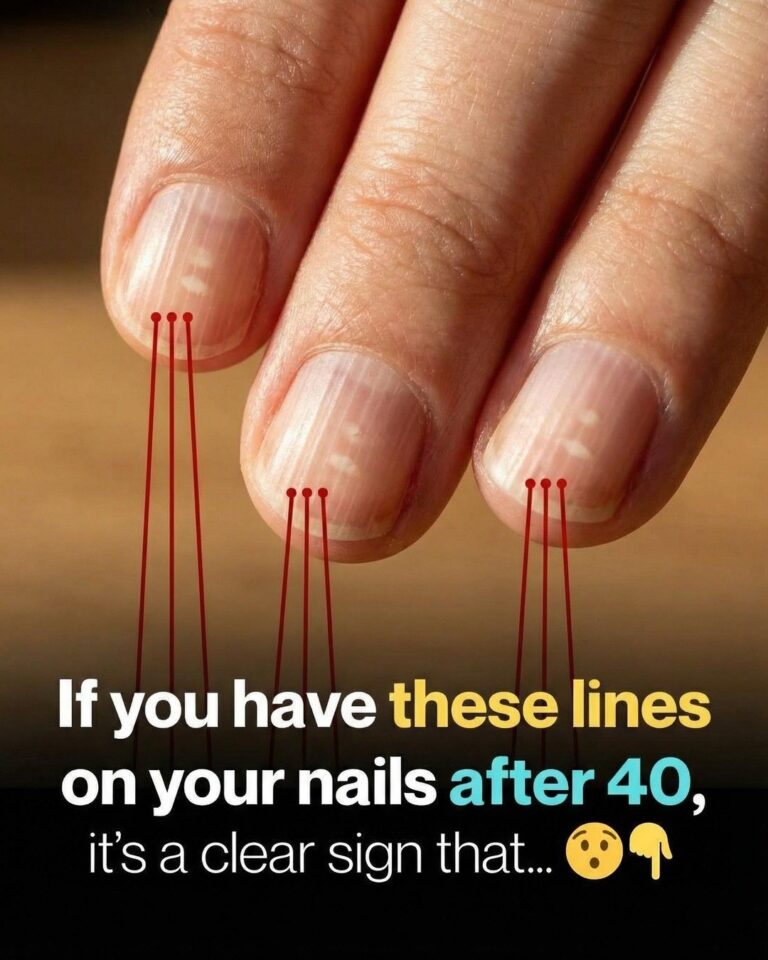 When you see these ridges on your nails after age 40, it’s an obvious warning – The Concealed Messages Behind Nail Appearances