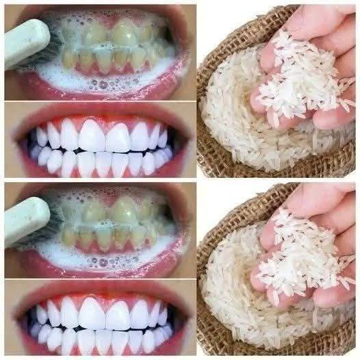 🦷 Teeth Whitening Trick with Rice — A Natural, 1-Minute Smile Brightener (Or Cautionary Tale?)