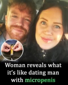 Woman opens up about love, laughs & life with her micro penis man