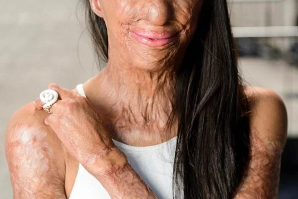 These are the consequences of sleeping co… See more