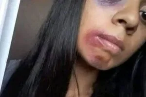 Young woman dies at the hands of her…