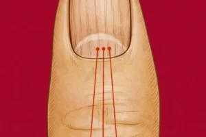 What Vertical Lines on Your Nails Can Reveal About Aging