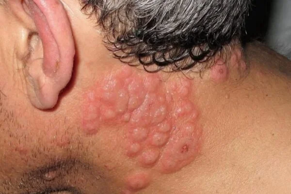 These are the consequences of sleeping with…See more